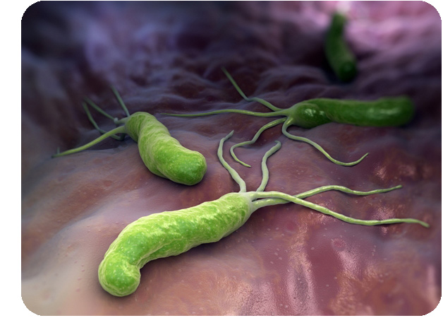 bakteria helicobacter pylori